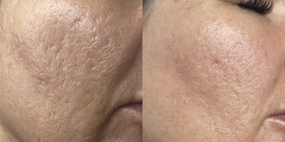 before-after-01