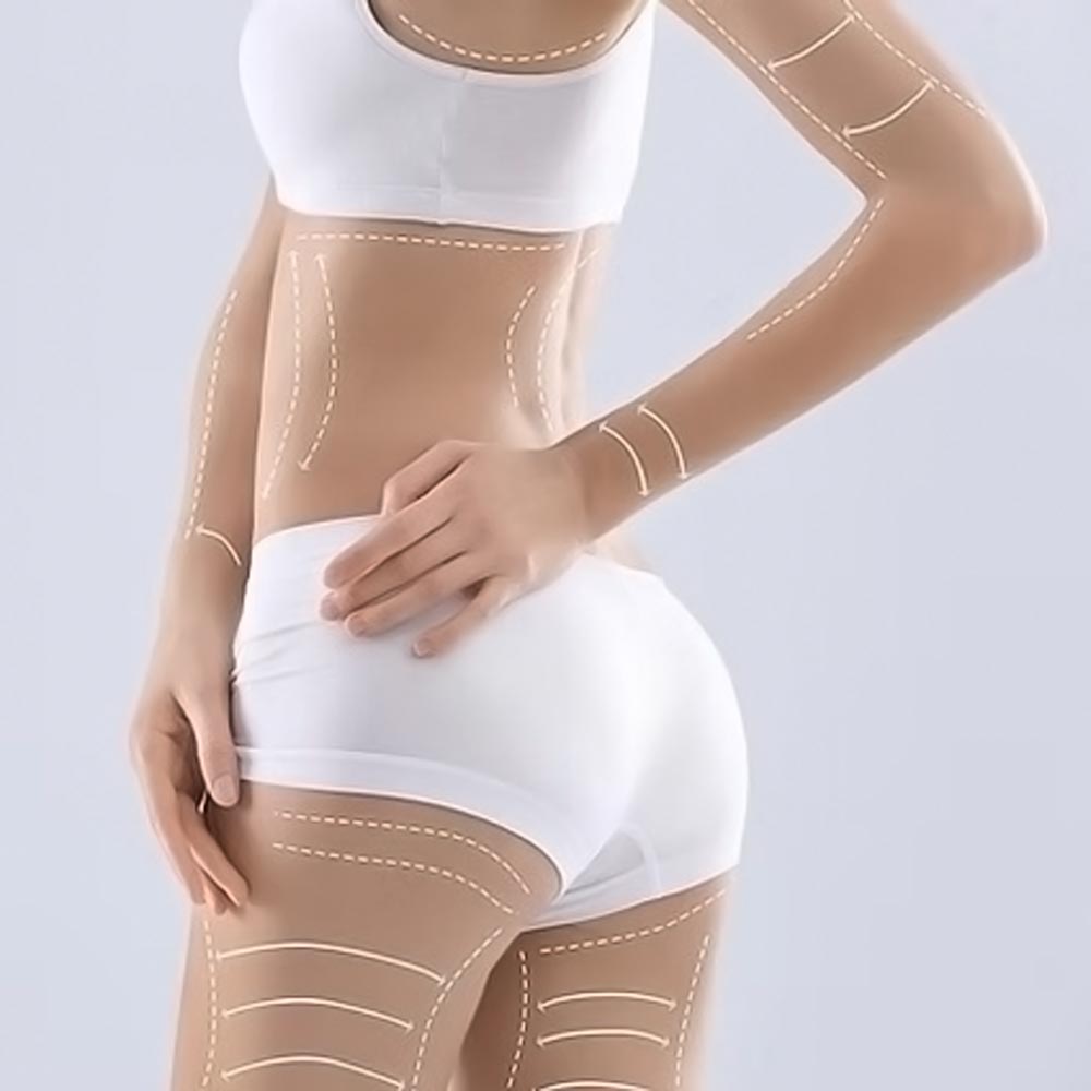 HIFU-Body
