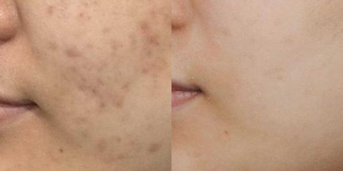 before-after-03