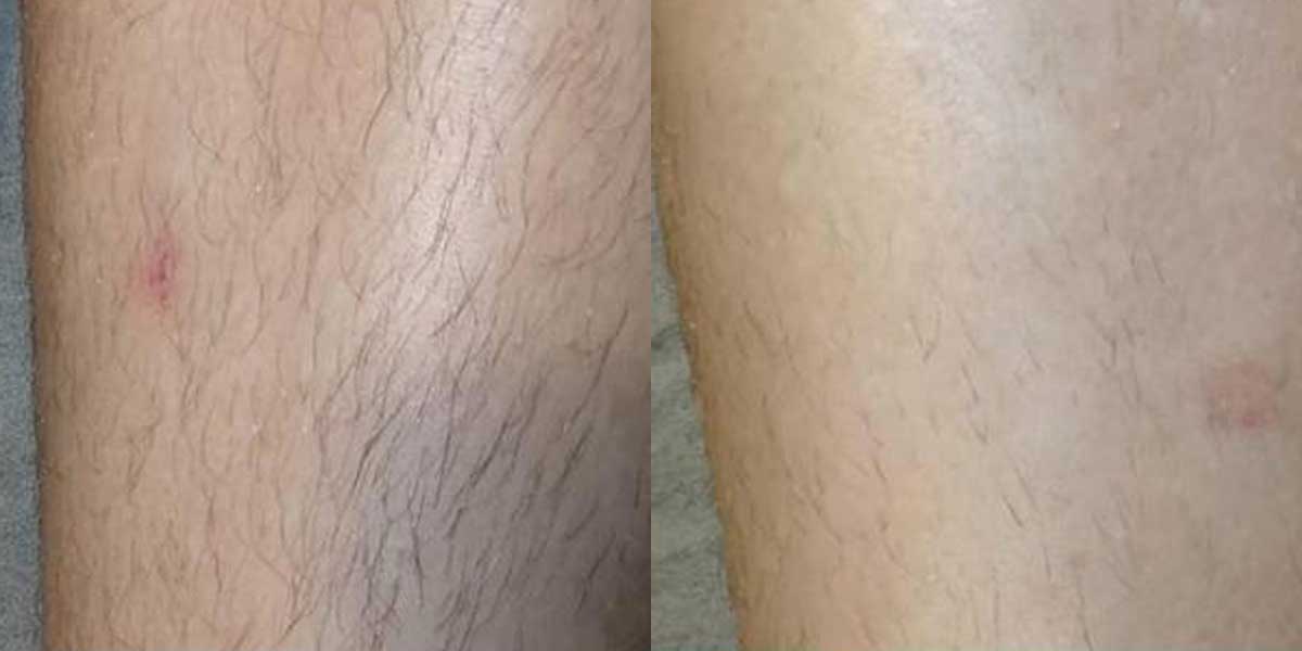 before-after-01