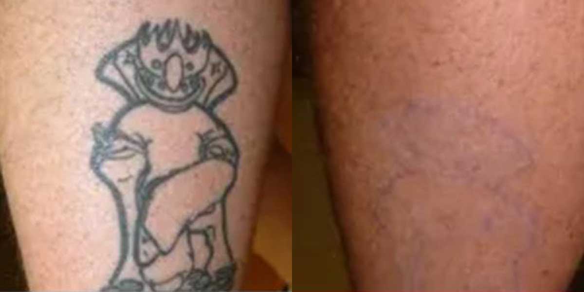 before-after-06