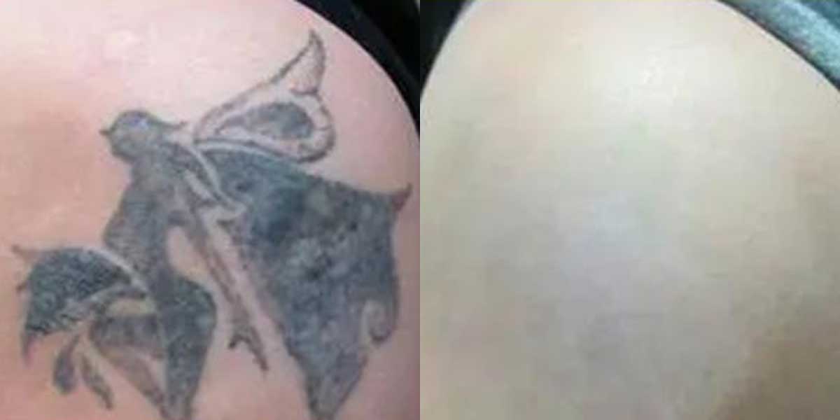 before-after-05