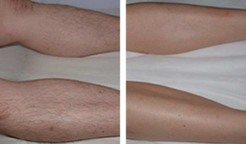 Before-After-01