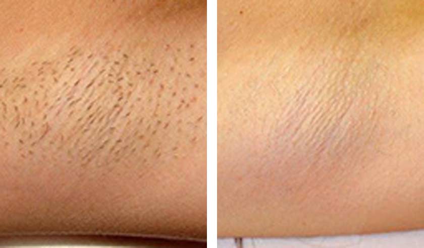 Before-After-02