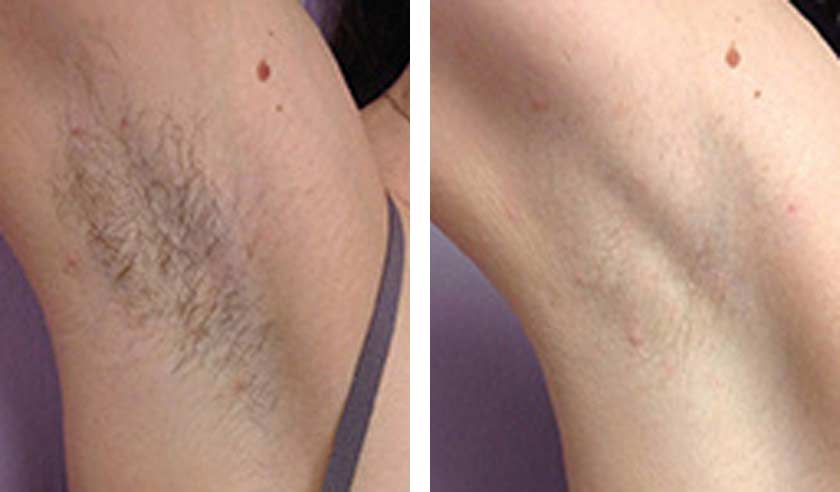 Before-After-03
