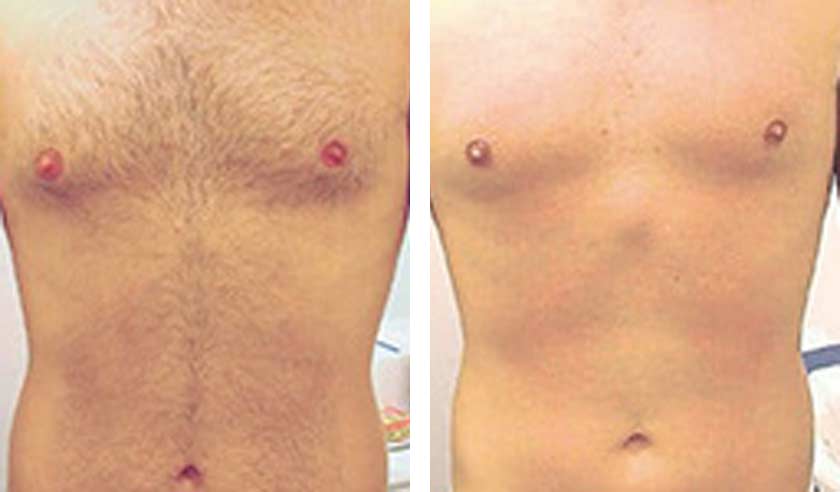 Before-After-04
