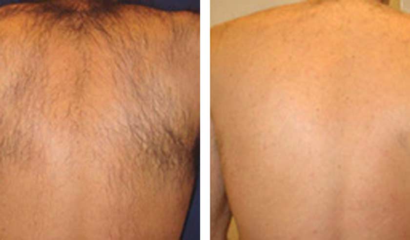 Before-After-05
