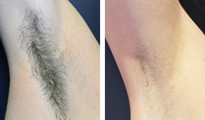 Before-After-06