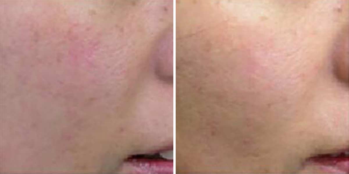Before-After-02