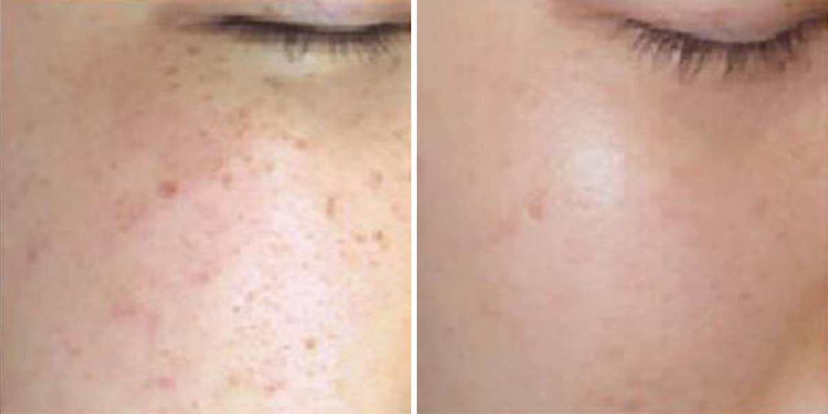 Before-After-03