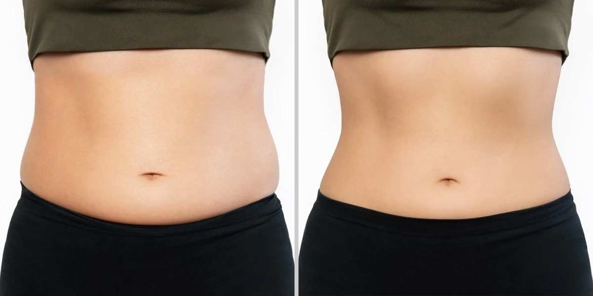 before-after-01