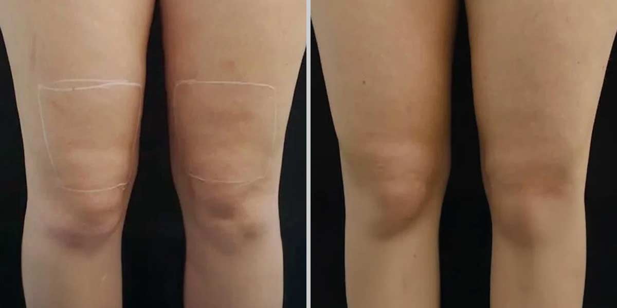 before-after-03