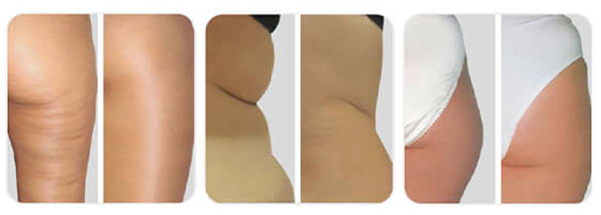 before-after-001