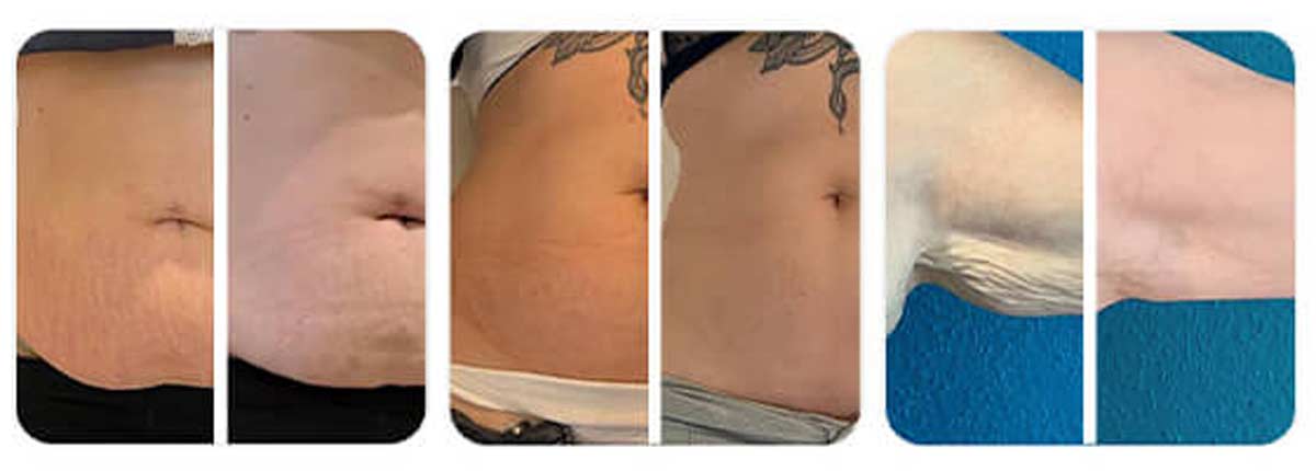 before-after-002