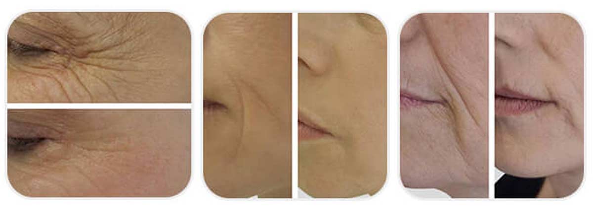 before-after-003