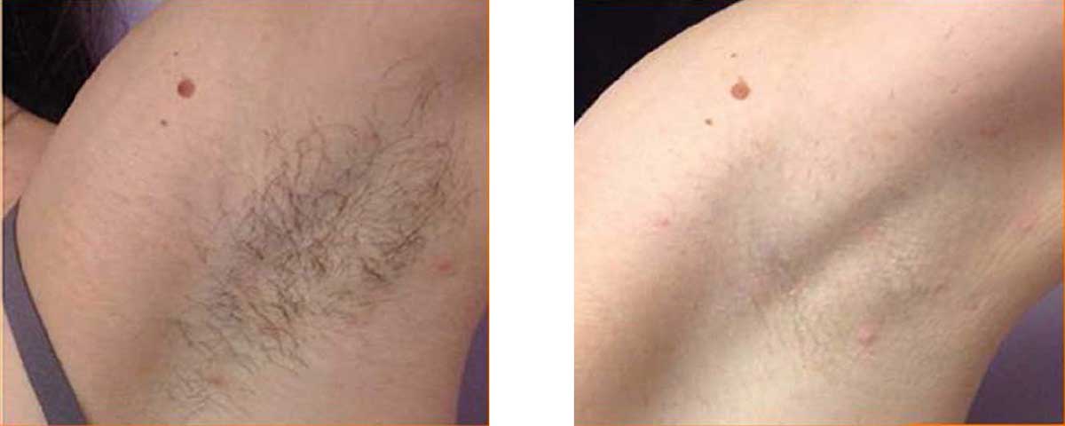 Before-After-02