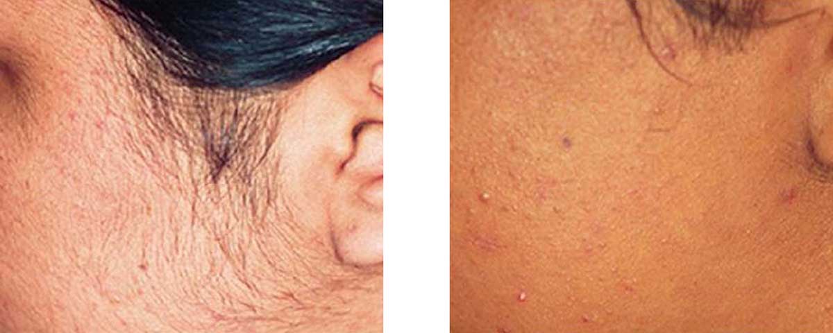Before-After-03