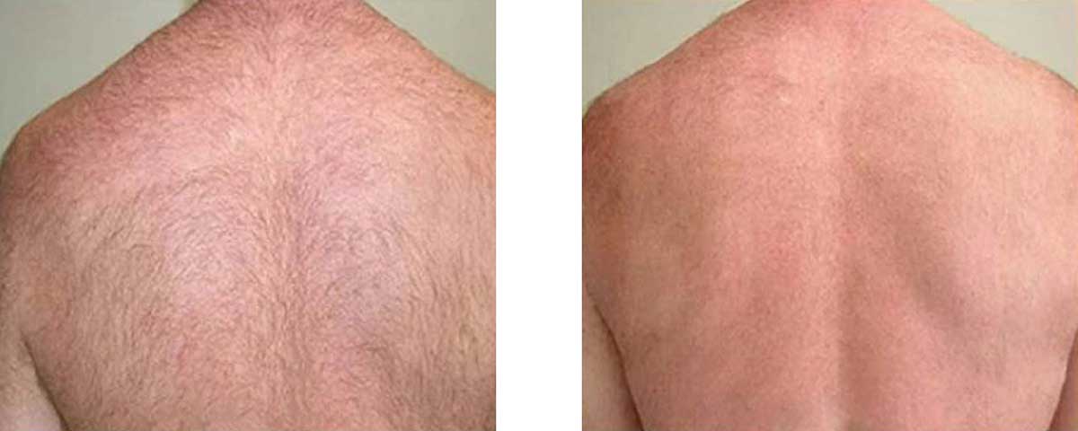 Before-After-04