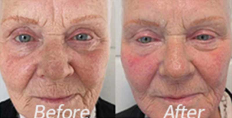 before-after-01