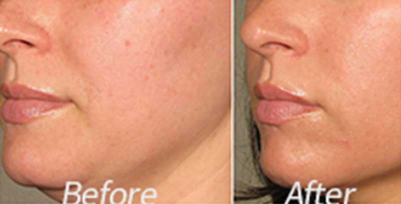 before-after-02
