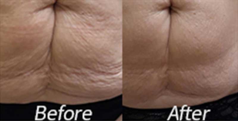 before-after-03