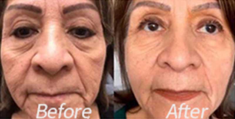 before-after-04