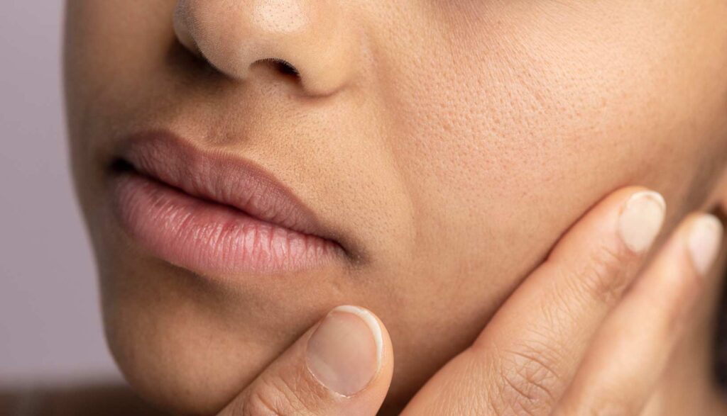 Benefits of CO2 Laser Skin Resurfacing