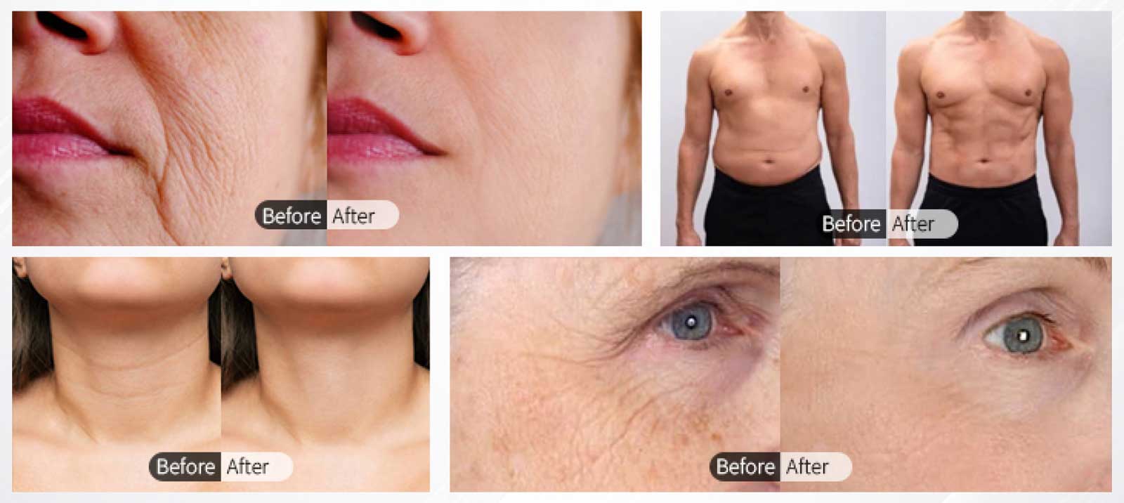 PRO-Before-After